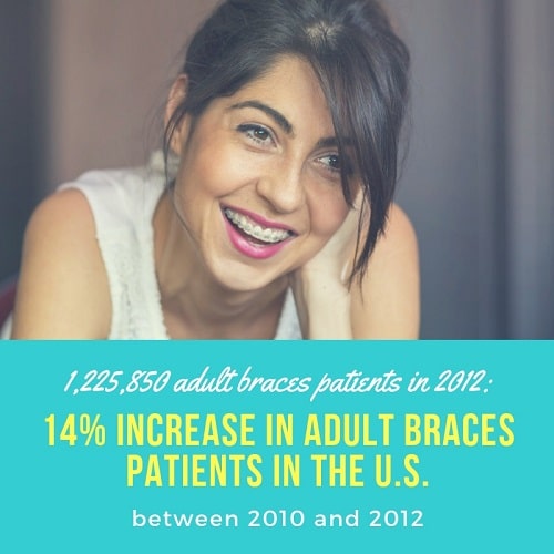 Braces adult patients graphic