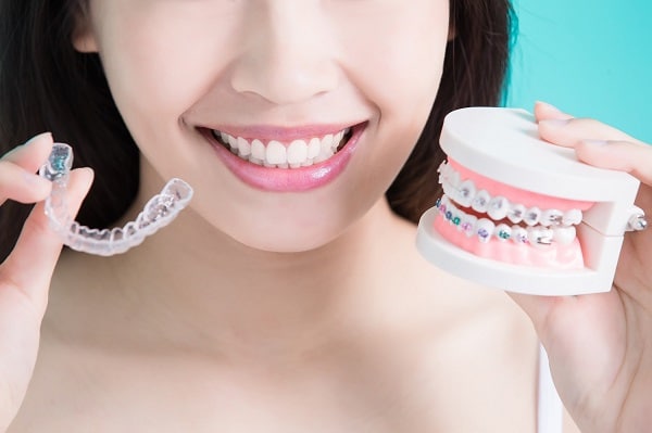 Invisalign vs braces in Stapleton CO