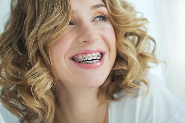 Close up headshot of woman with curly blonde hair and white clothes smiling with metal braces and solid white background