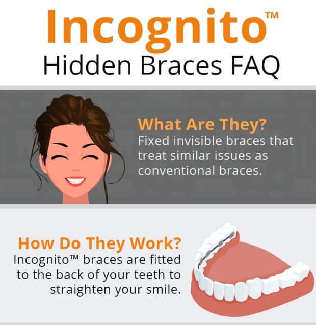 incognito hidden braces faq 5fa95f0809c34