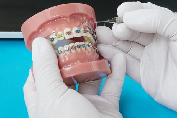 the difference between orthodontists and dentists 5fa95f9e61478