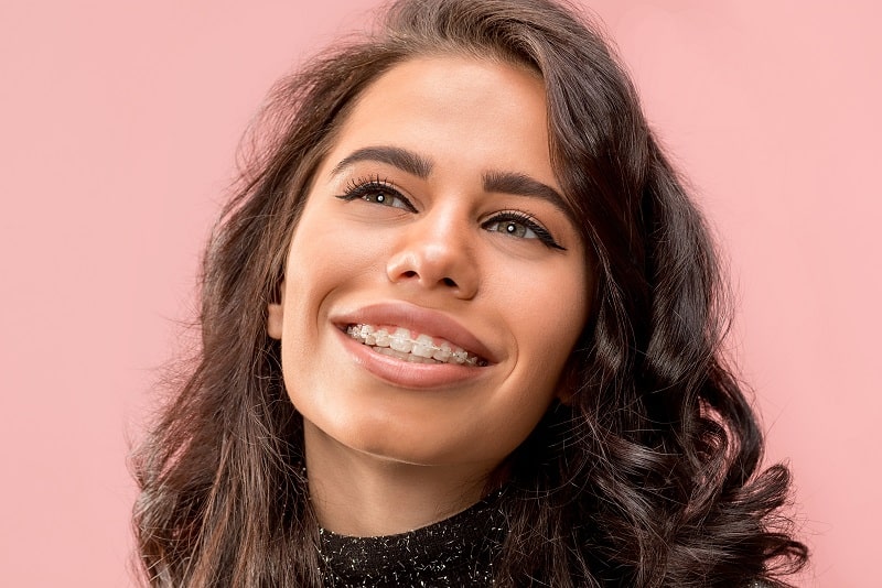 ceramic braces in Denver