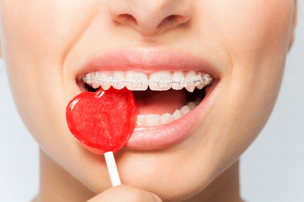 Woman eating candy while wearing braces