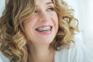 Young,Woman,In,Braces