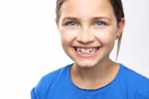 Healthy,,Beautiful,Smile,,The,Child,To,The,Dentist.portrait,Of,A