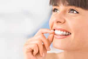 Woman Wearing Orthodontic silicone clear aligners