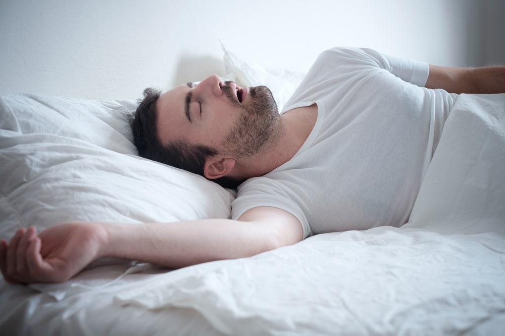 A man with sleep apnea lying on his back and snoring