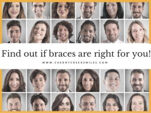 imgpsh fullsize anim 5 Orthodontics in Denver CO